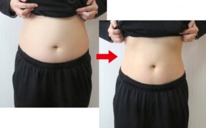 ダイエットビフォーアフター